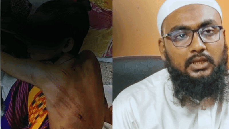 নরসিংদীতে মাদ্রাসা শিক্ষকের মারধরে আহত শিশু, শিক্ষক গ্রেপ্তার