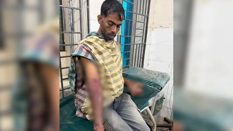বিদ্যুতের খুঁটিতে বেঁধে পাইপ দিয়ে পিটুনি, এসিডে ঝলসে দিল যুবকের দুই হাত