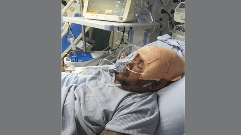 ব্রেন টিউমারের ‘ভুল অস্ত্রোপচারে’ মৃত্যুর মুখে কৃষক মাহাবুব, অস্বীকার চিকিৎসকের