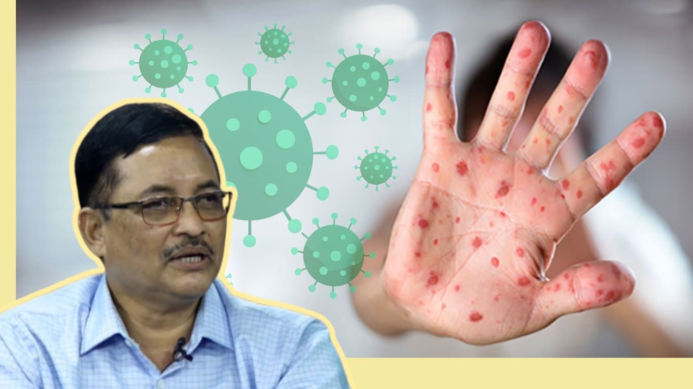 হামের পাশাপাশি শিশুরা অ্যাডিনোতে আক্রান্ত হচ্ছে: ডা. মুয়াজ