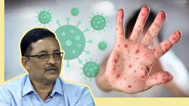 হামের পাশাপাশি শিশুরা অ্যাডিনোতে আক্রান্ত হচ্ছে: ডা. মুয়াজ