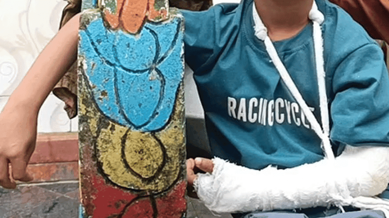 মানিকগঞ্জে মাদ্রাসাশিক্ষকের বেত্রাঘাতে শিশুর হাতের হাড় ফাটার অভিযোগ