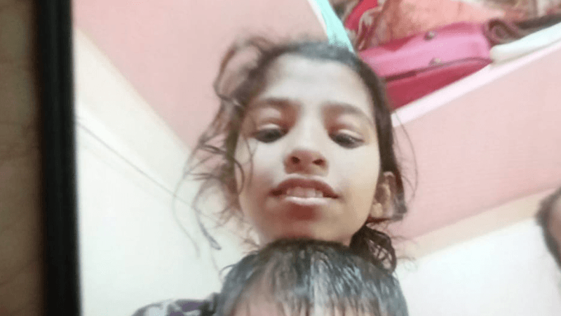 গুলিবিদ্ধ শিশু রেশমির অবস্থা সংকটাপন্ন, চোখ থেকে গুলি বের করা যায়নি