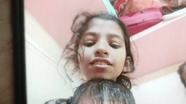 গুলিবিদ্ধ শিশু রেশমির অবস্থা সংকটাপন্ন, চোখ থেকে গুলি বের করা যায়নি