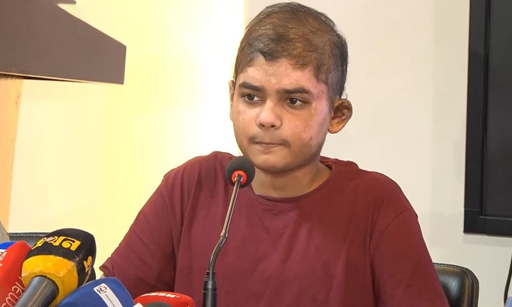 মাইলস্টোন ট্র্যাজেডি: ১২২ দিন পর হাসপাতাল থেকে ছাড়া পেল দগ্ধ আরিয়ান