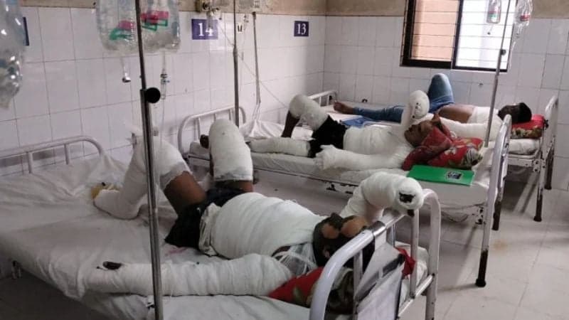 চট্টগ্রামে লবণ কারখানায় আগুন, ১০ শ্রমিক দগ্ধ