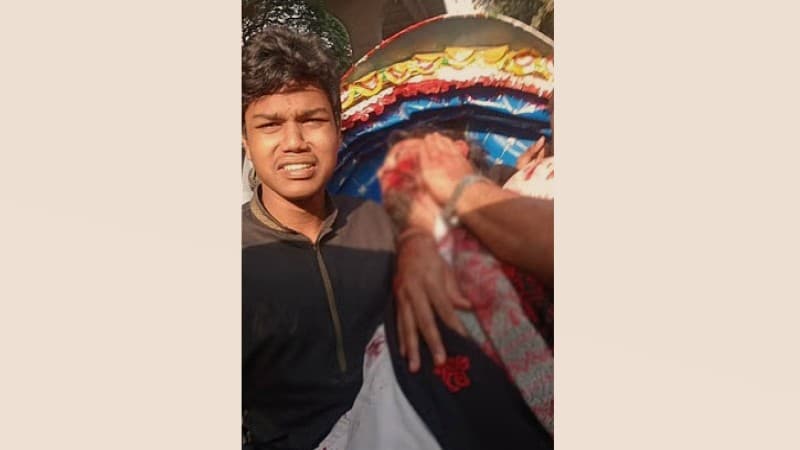 মাথায় বুলেট, লাইফ সাপোর্টে হাদি: ঢামেক পরিচালক