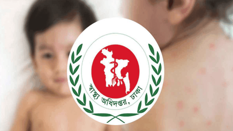 একদিনে হাম ও ও হামের উপসর্গে আরও ৬ জনের মৃত্যু