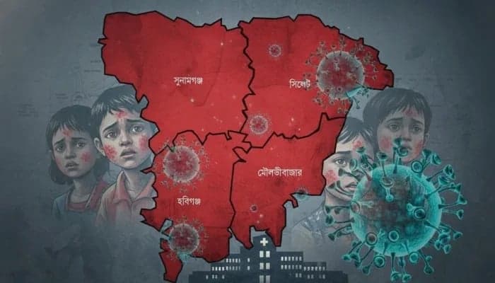 সিলেটে হামে আক্রান্ত ও উপসর্গ নিয়ে মৃতের সংখ্যা অর্ধশত ছাড়ালো