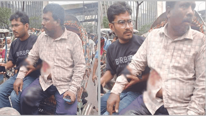 মতিঝিলে ব্যবসায়ীকে গুলি করে ১৭ লাখ টাকা ছিনতাই