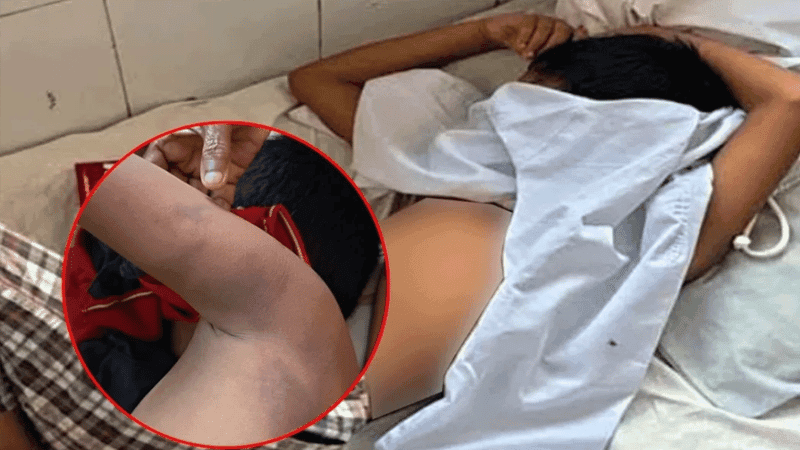 মাদ্রাসা শিক্ষকের বেধড়ক মারধরে হাসপাতালে ৭ বছরের শিশু