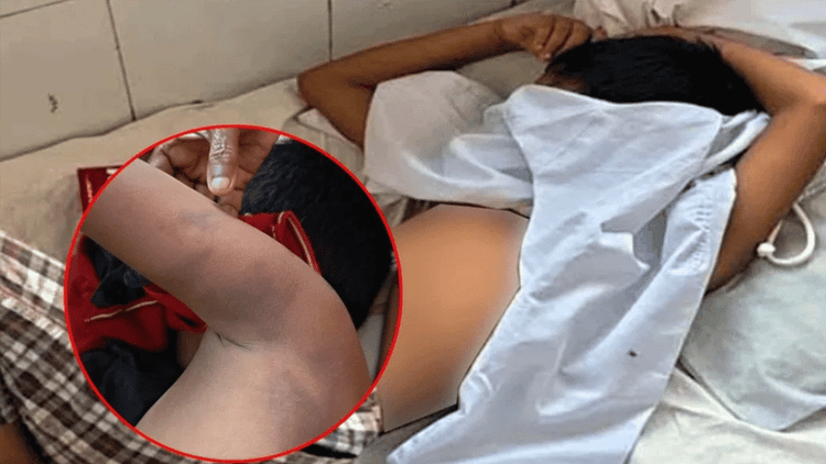 মাদ্রাসা শিক্ষকের বেধড়ক মারধরে হাসপাতালে ৭ বছরের শিশু