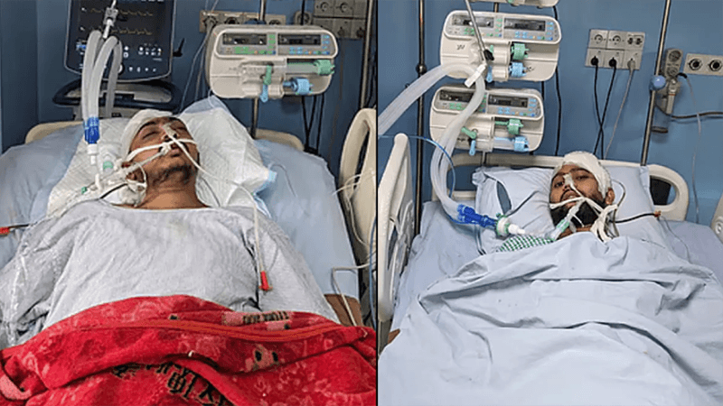 চবিতে সংঘর্ষে আহত দুই শিক্ষার্থী লাইফ সাপোর্টে