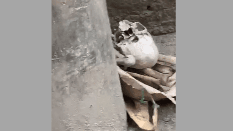 মোহাম্মদপুরে সড়কে মিলল মাথার খুলি ও হাড়