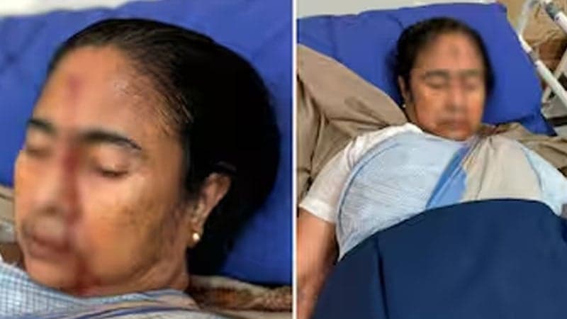 পড়ে গিয়ে কপাল ফাটল মমতার, হাসপাতালে ভর্তি