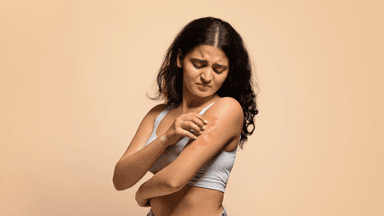 চুলকানি কমেছে মানেই সেরে যায়নি; বর্ষায় ছত্রাকের ফাঁদ থেকে রক্ষার উপায়