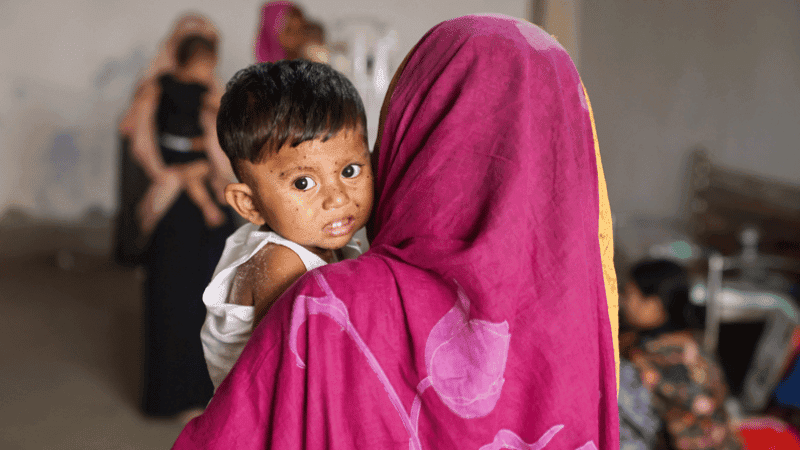 চলতি বছর সারাদেশে ৬৭৬ শিশু হামে আক্রান্ত